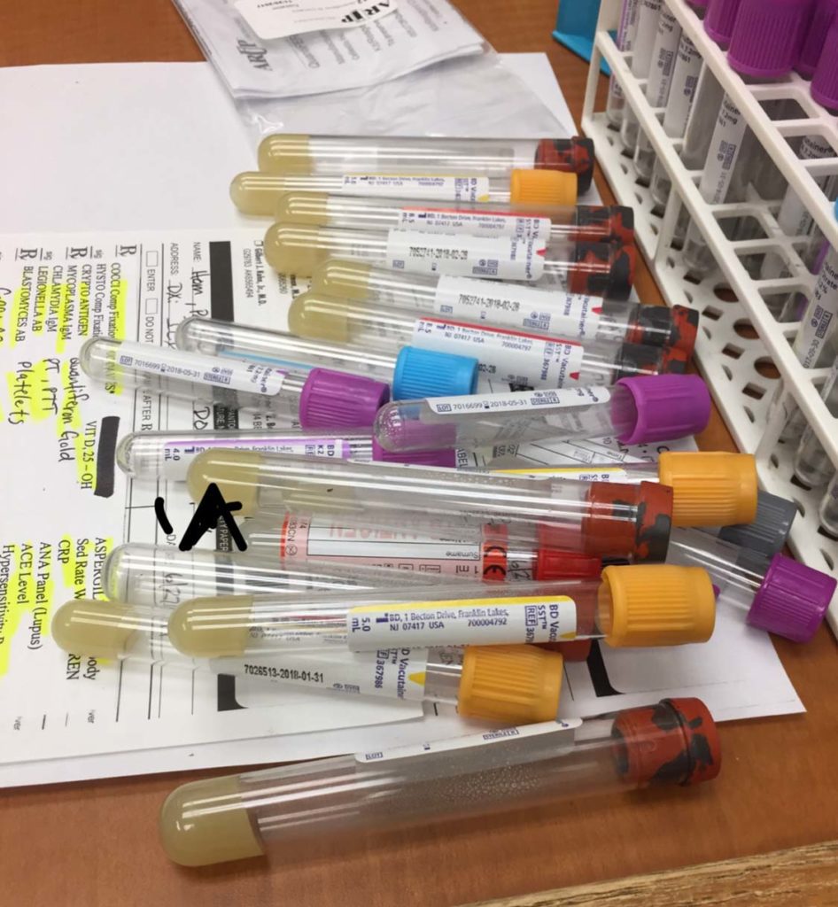 Common Blood Collection Tubes